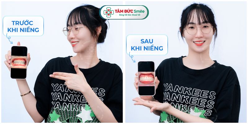 nieng-rang-gia-bao-nhieu-1