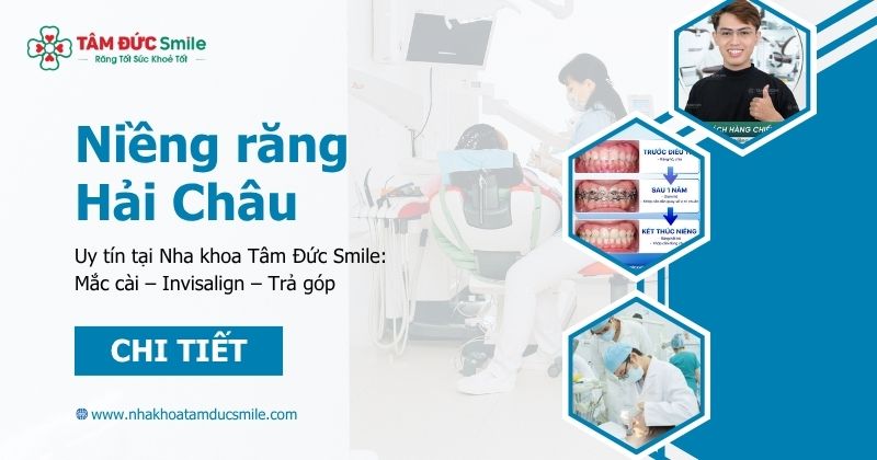 Niềng răng Hải Châu uy tín tại Nha khoa Tâm Đức Smile: Mắc cài – Invisalign – Trả góp