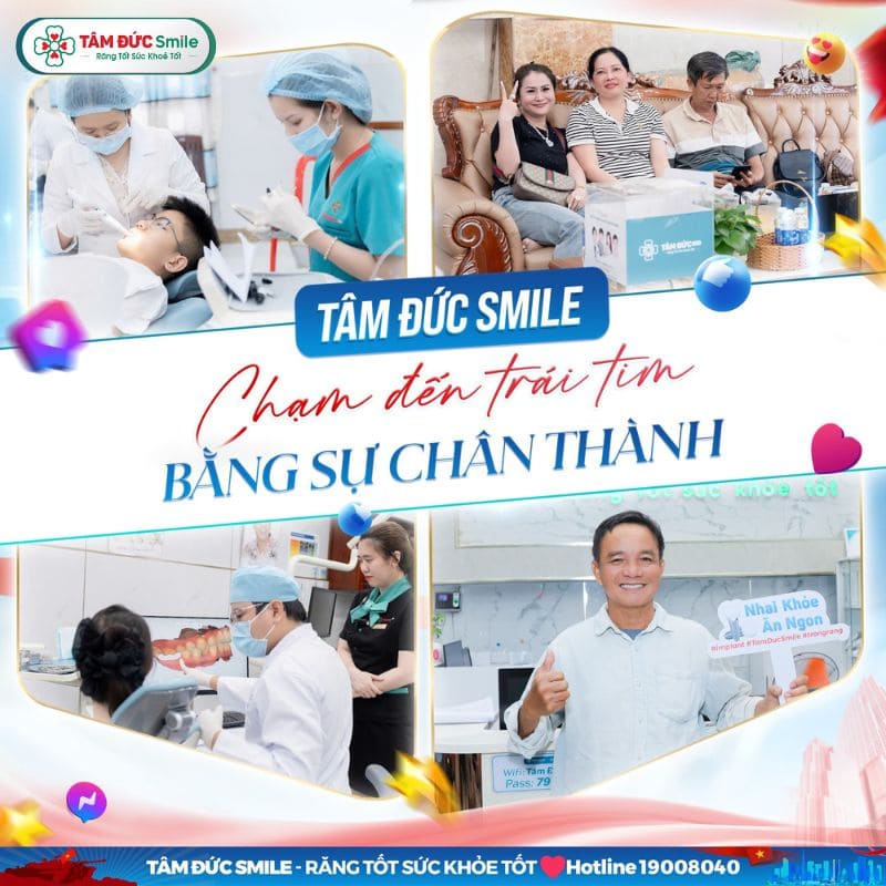 nieng-rang-ham-duoi-gia-bao-nhieu-5