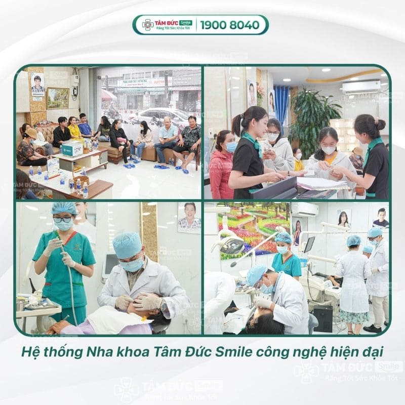 nieng-rang-mom-gia-bao-nhieu-5