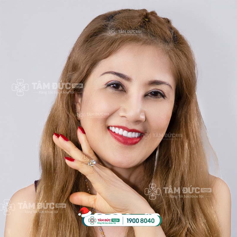 khách hàng chăm sóc răng miệng tại nha khoa tâm đức smile