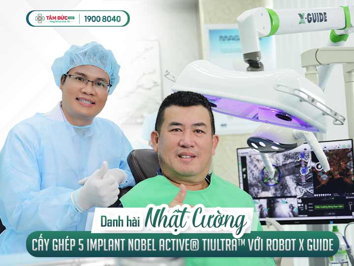 phục hình sứ tức thì sau khi cấy ghép implant cho danh hài Nhật Cường