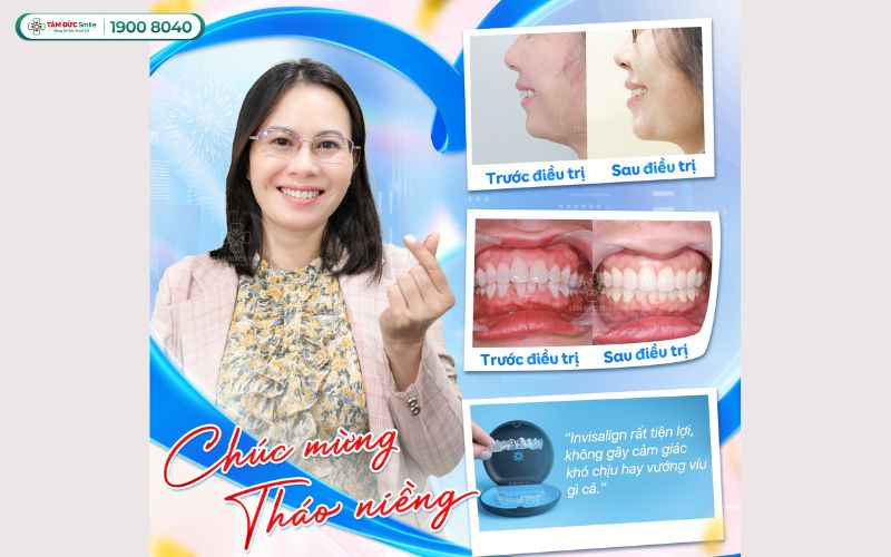 phuong-phap-nieng-rang-1