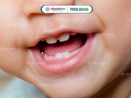 quá trình mọc răng ở trẻ