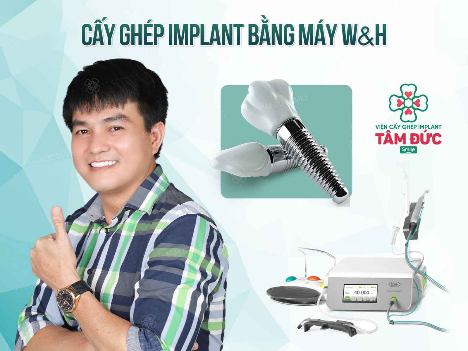 quy trình cấy ghép implant