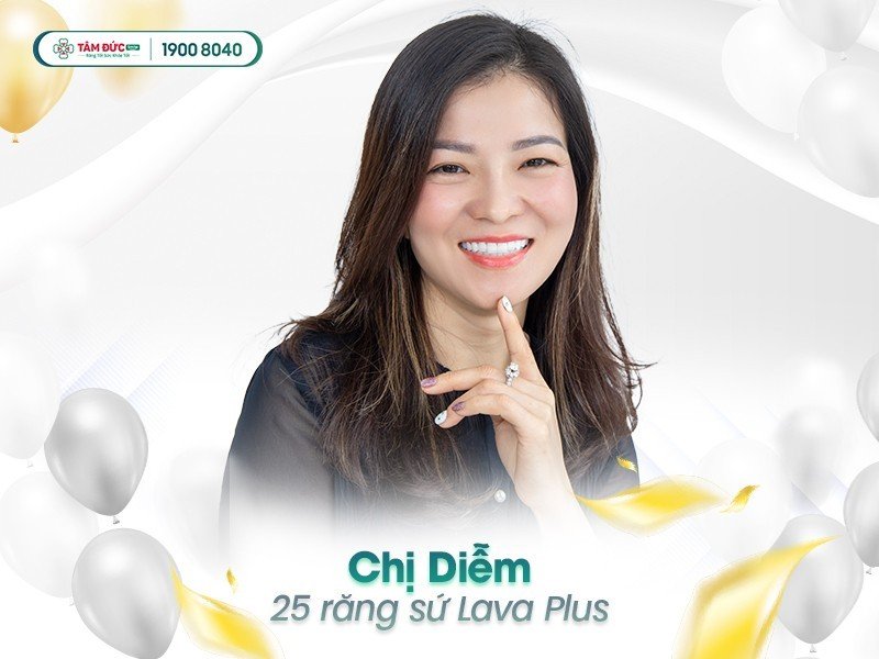 Chị Diễm sau khi bọc răng sứ tại nha khoa Tâm Đức Smile