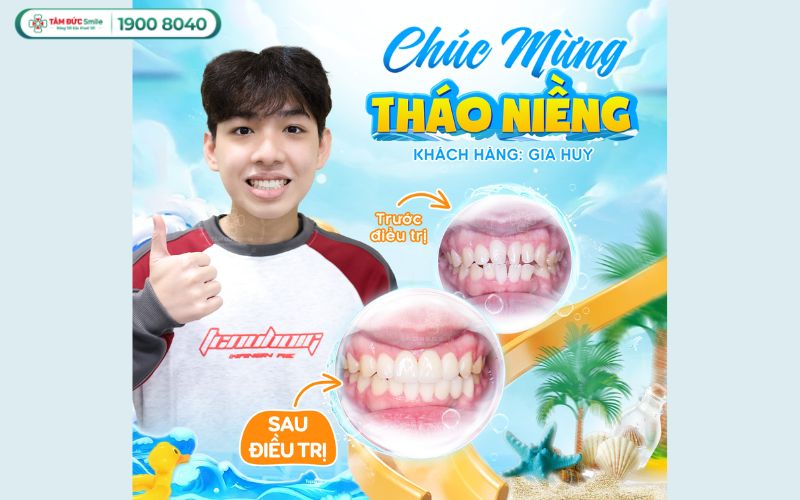 rang-chuot-6