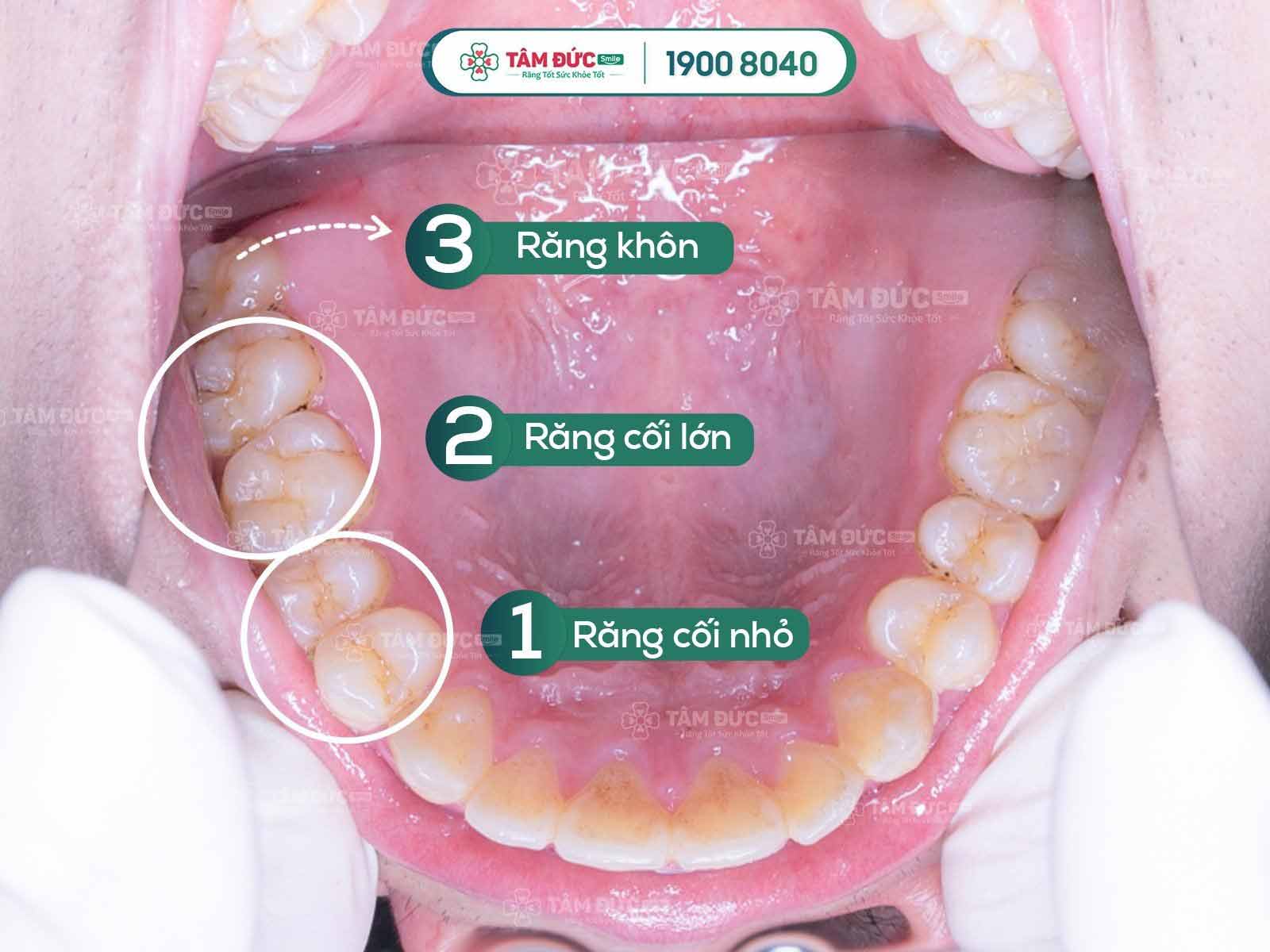 4. Chăm Sóc Răng Hàm Đúng Cách