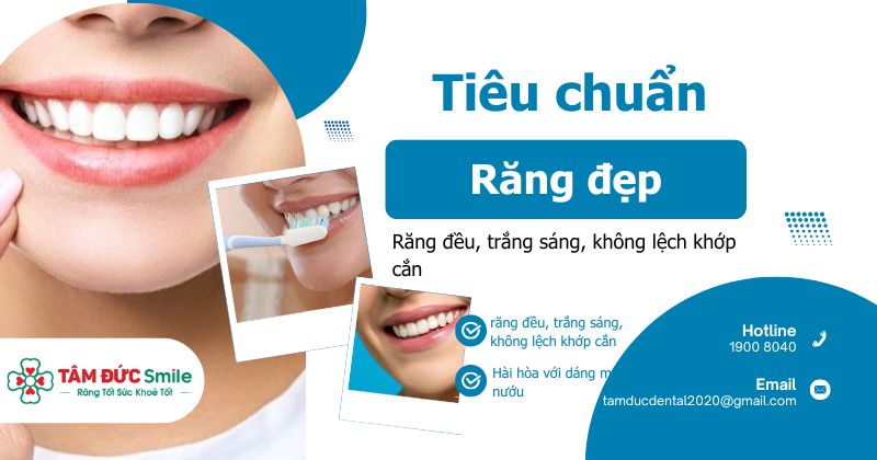 Tiêu chuẩn răng đẹp hiện đại và giải pháp tối ưu tại Nha khoa Tâm Đức Smile