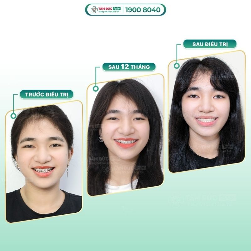 rang-mom-4