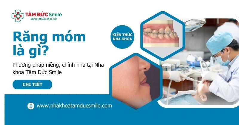 Răng móm là gì? Phương pháp niềng, chỉnh nha tại Nha khoa Tâm Đức Smile