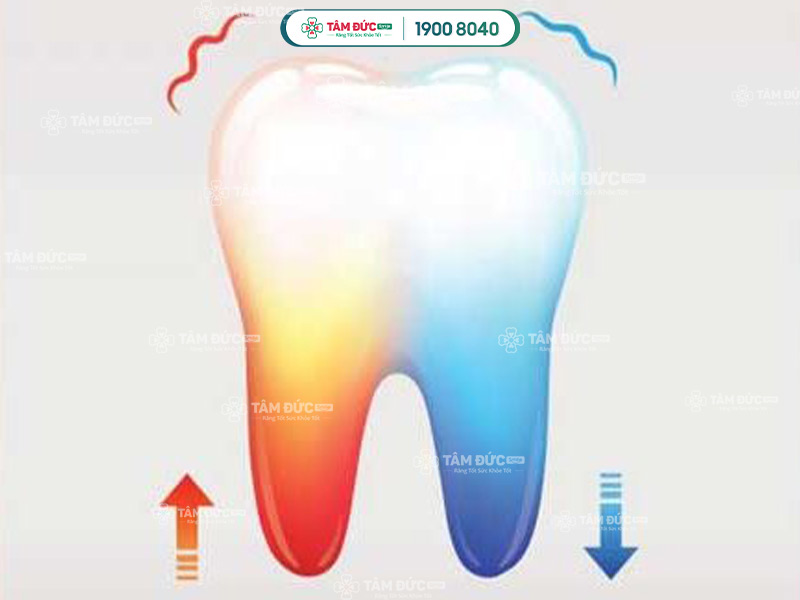 hình ảnh giải đáp răng nhạy cảm là gì