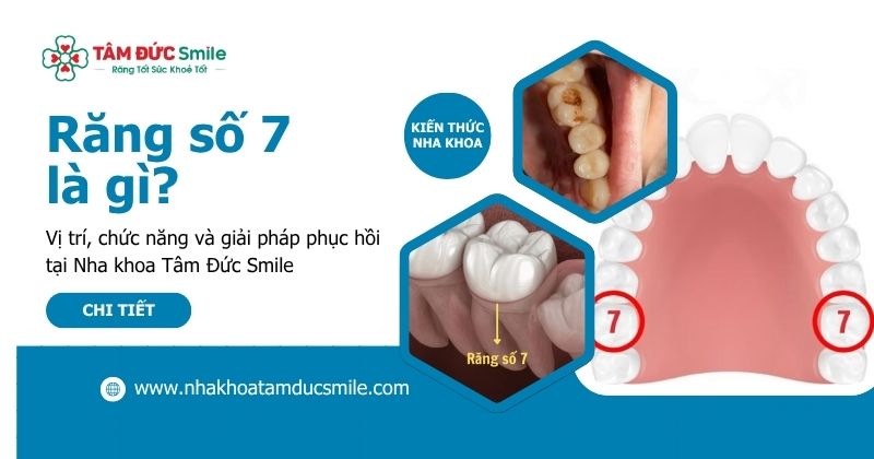 Răng số 7 là gì? Vị trí, chức năng và giải pháp phục hồi tại Nha khoa Tâm Đức Smile