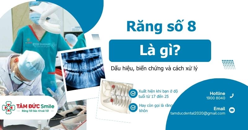 Răng số 8 là gì? Dấu hiệu, biến chứng và cách xử lý