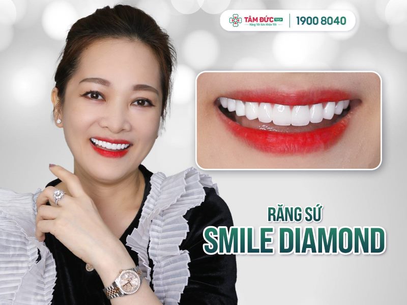 răng sứ cao cấp smile diamond