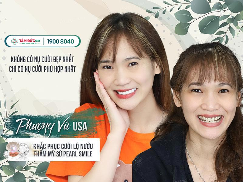 Chị Phượng Vũ sau khi bọc răng sứ ngọc trai tại nha khoa Tâm Đức Smile