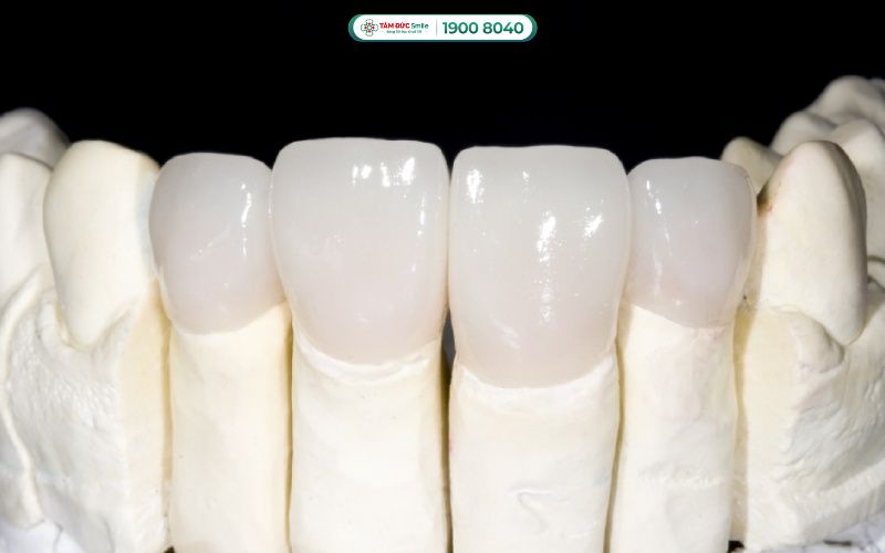 rang-su-zirconia-1