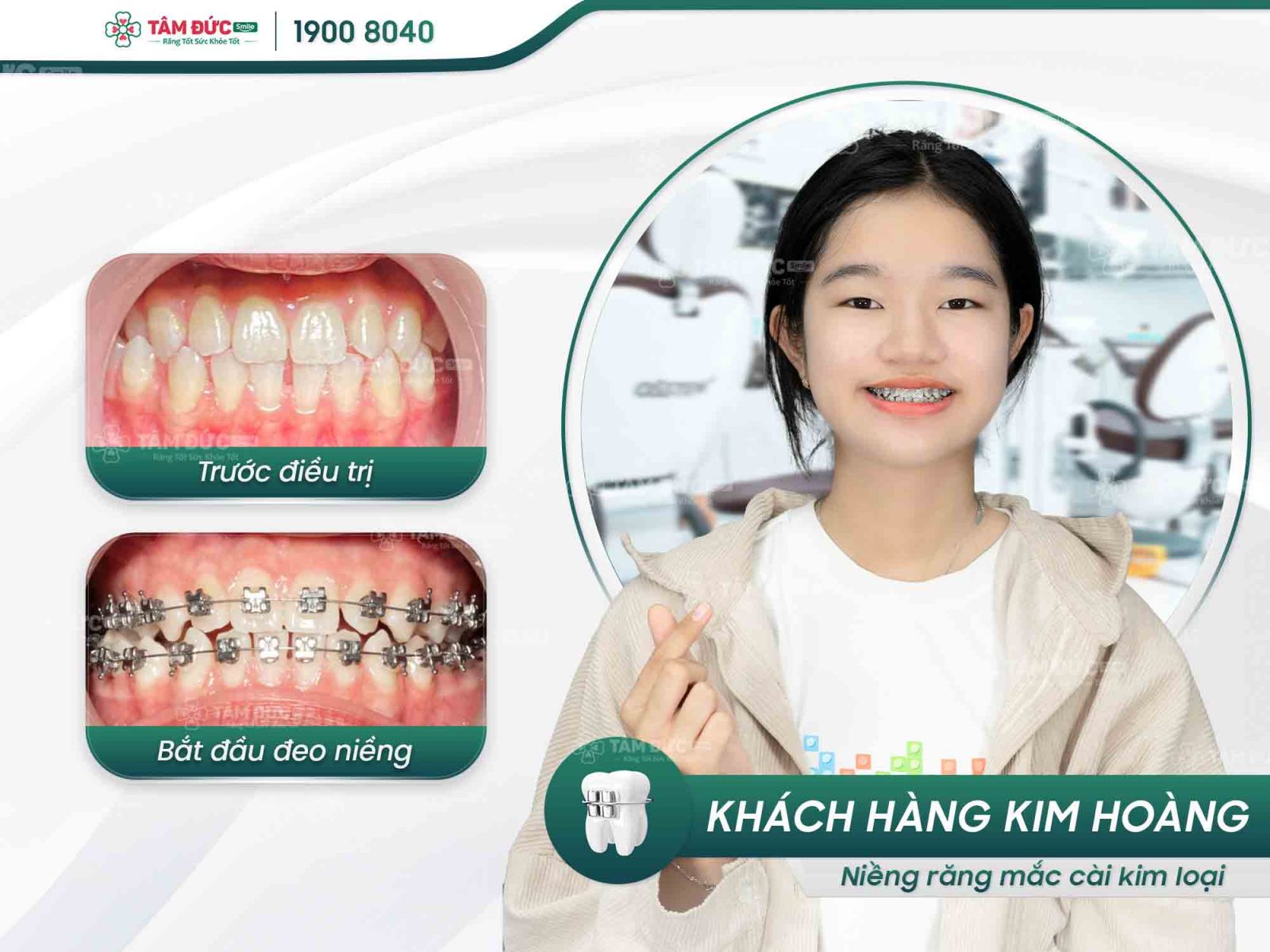 khách hàng niềng răng tại nha khoa Tâm Đức Smile