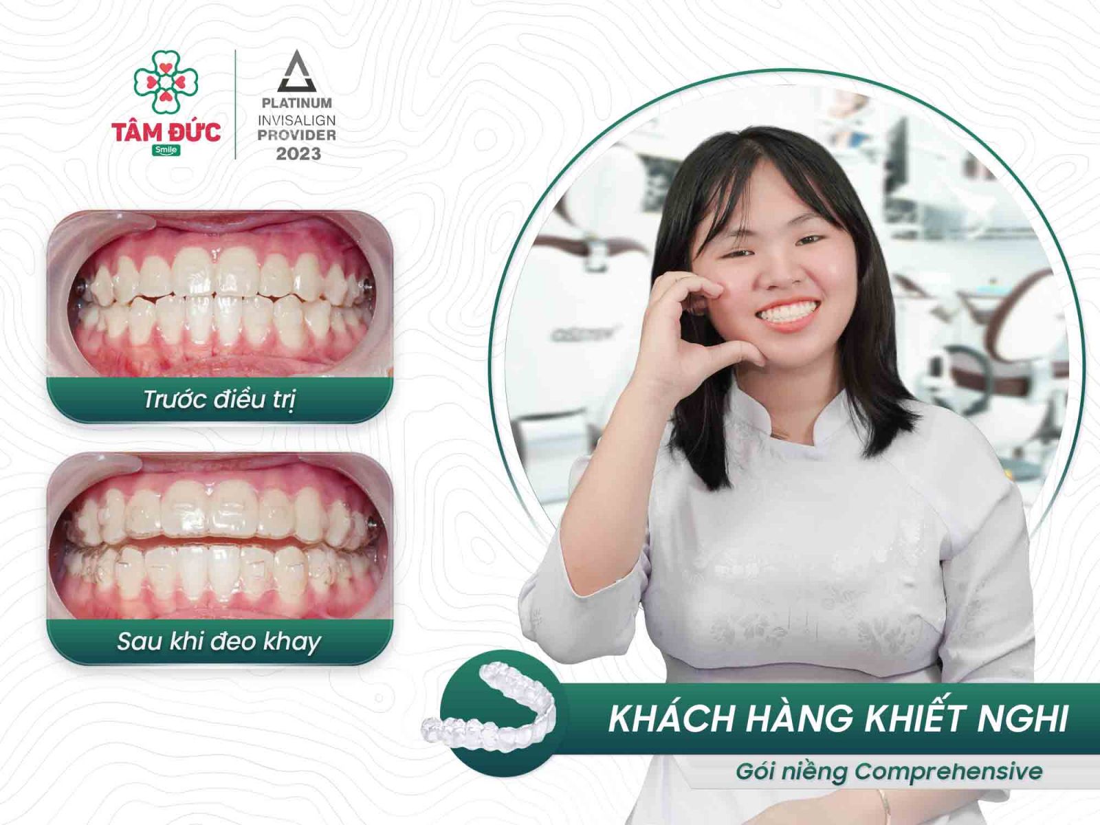 khách hàng niềng răng tại nha khoa Tâm Đức Smile