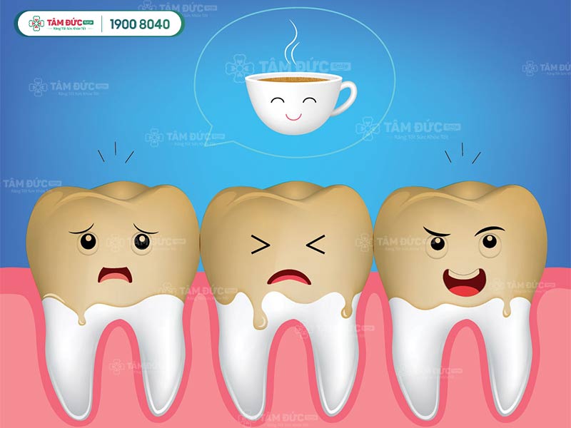 3 chiếc răng bị nhiễm màu từ cà phê