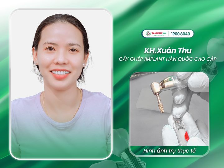 tại sao nên trồng implant sau khi mất răng