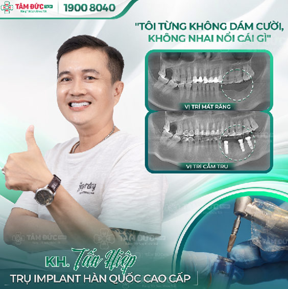 khách hàng trồng răng giả tạm thời tại nha khoa Tâm Đức Smile