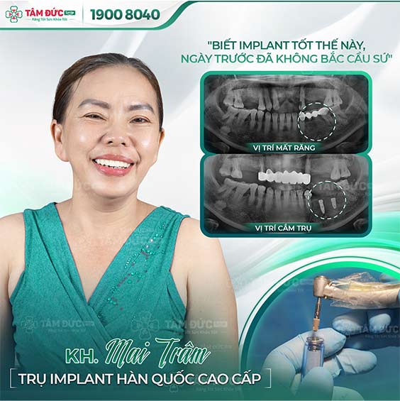 khách hàng trồng răng giả tạm thời tại nha khoa Tâm Đức Smile