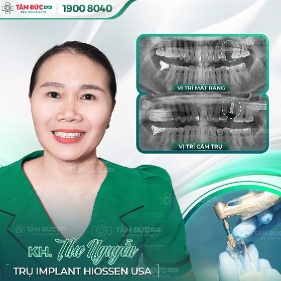 khách hàng trồng răng implant tại nha khoa Tâm Đức Smile