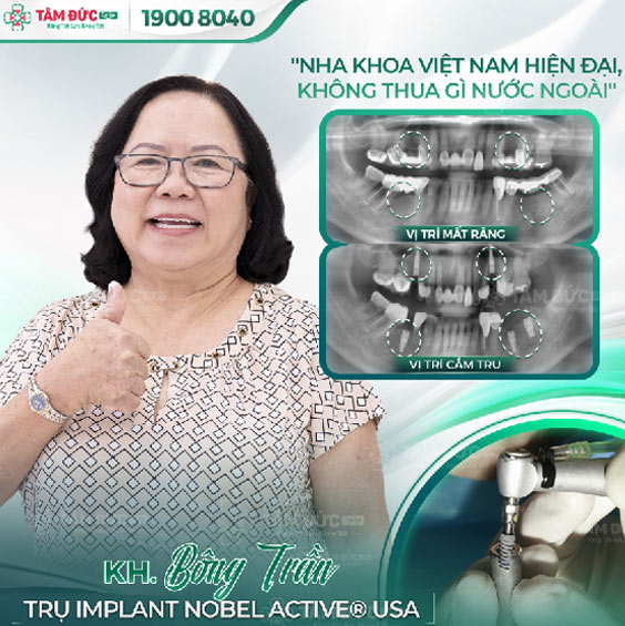 khách hàng trồng răng Implant tại nha khoa Tâm Đức Smile