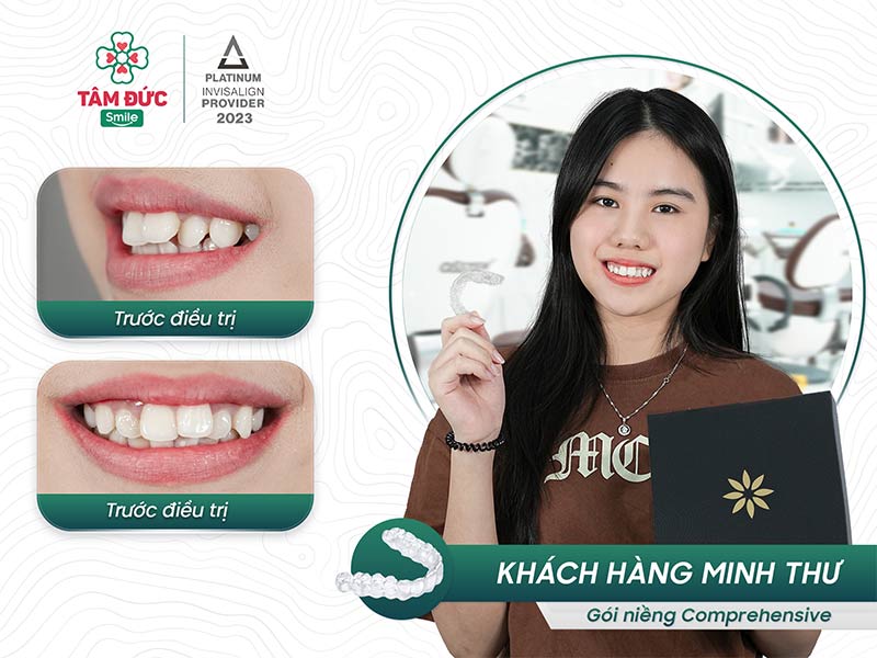 khách hàng niềng răng trong suốt tại nha khoa Tâm Đức Smile