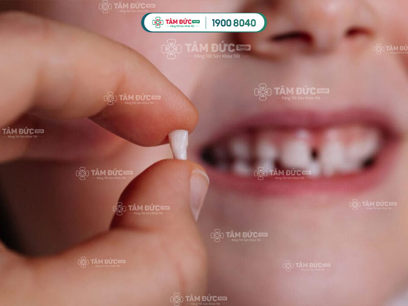 răng lung lay bao lâu thì rụng