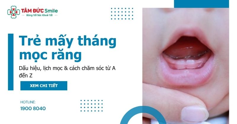 Trẻ mấy tháng mọc răng? Dấu hiệu, lịch mọc & cách chăm sóc từ A đến Z