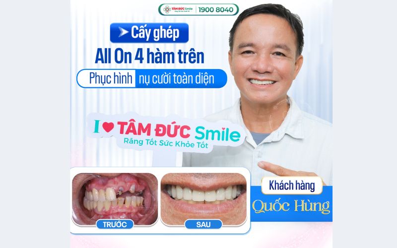 trong-rang-8
