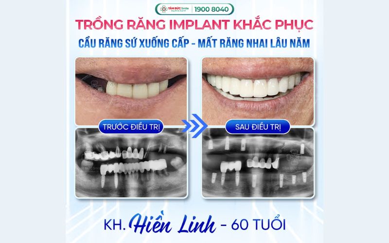 trong-rang-9