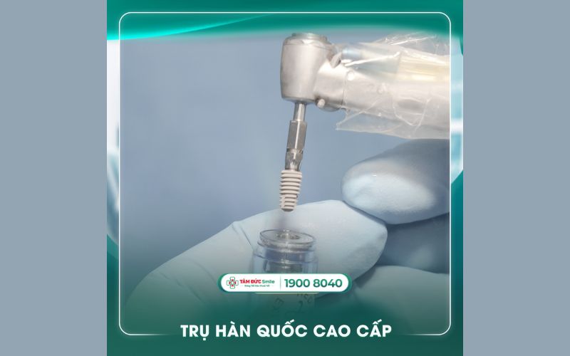 trong-rang-implant-all-on-4-4