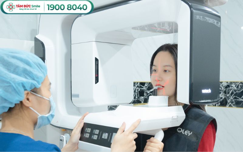 trong-rang-implant-all-on-4-6