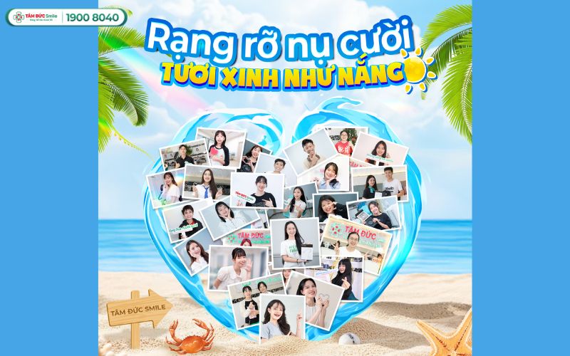 trong-rang-implant-all-on-4-9