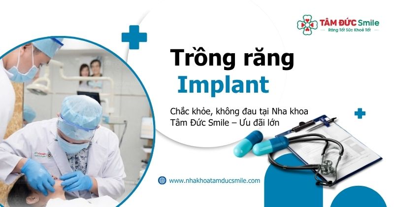 Trồng răng Implant chắc khỏe, không đau tại Nha khoa Tâm Đức Smile – Ưu đãi lớn