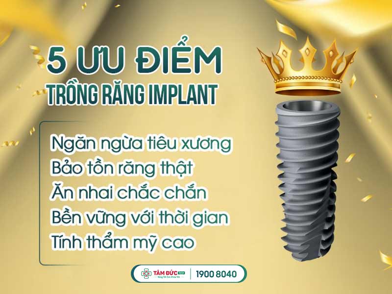 trồng răng Implant Hàn Quốc giá bao nhiêu tiền