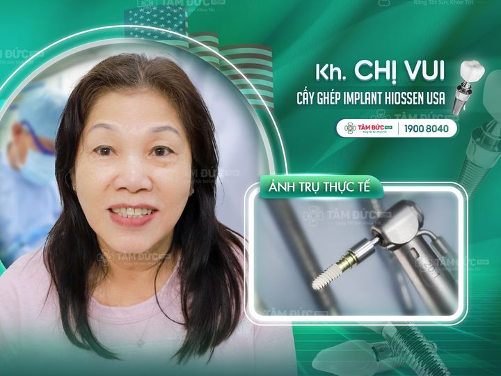 Chị Vui sau khi trồng răng giả implant tại Tâm Đức Smile