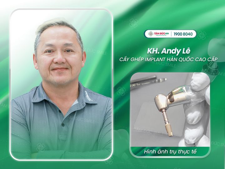 trồng răng implant mất bao lâu thì hoàn thành