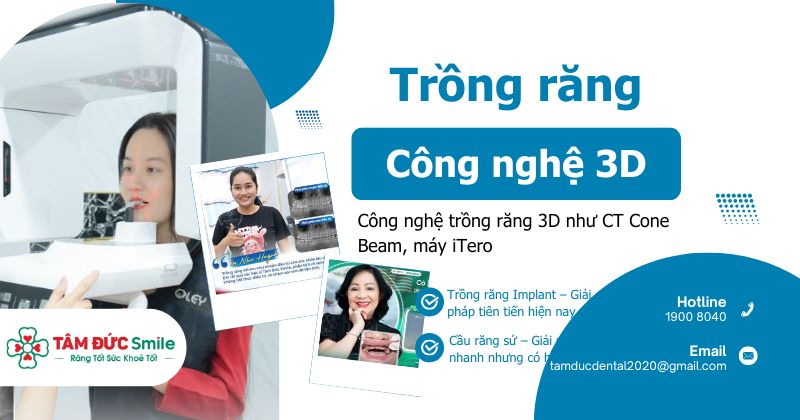 Trồng răng không đau bằng công nghệ 3D – ăn nhai như thật