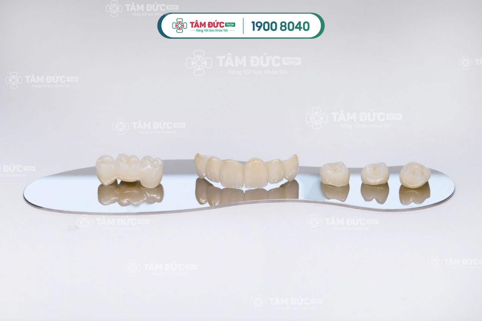 Trường hợp nào không nên cấy ghép implant