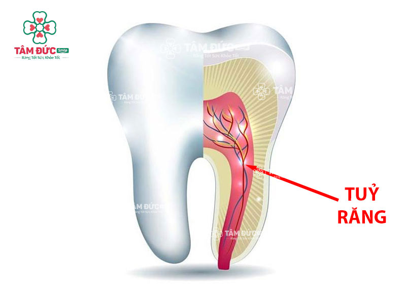 hình ảnh tuỷ răng giải đáp tuỷ răng là gì