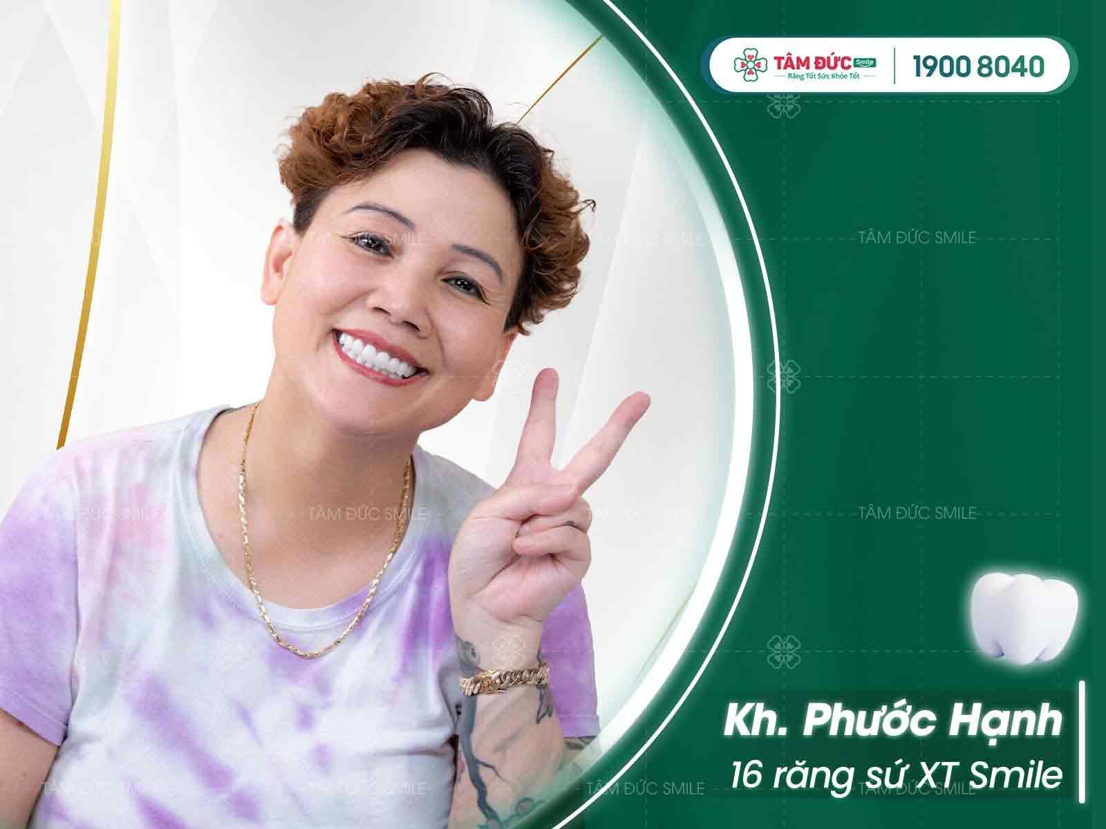 chị Phước Hạnh sau khi bọc răng sứ chữa viêm nướu răng