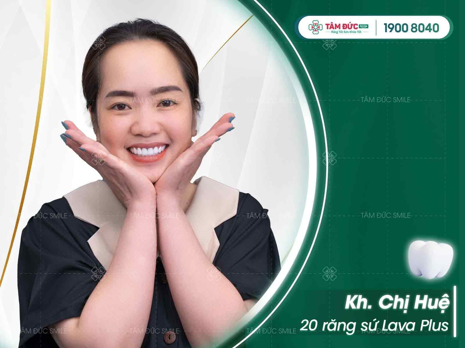 chị Huệ sau khi bọc răng sứ chữa viêm nướu răng tại nha khoa Tâm Đức Smile