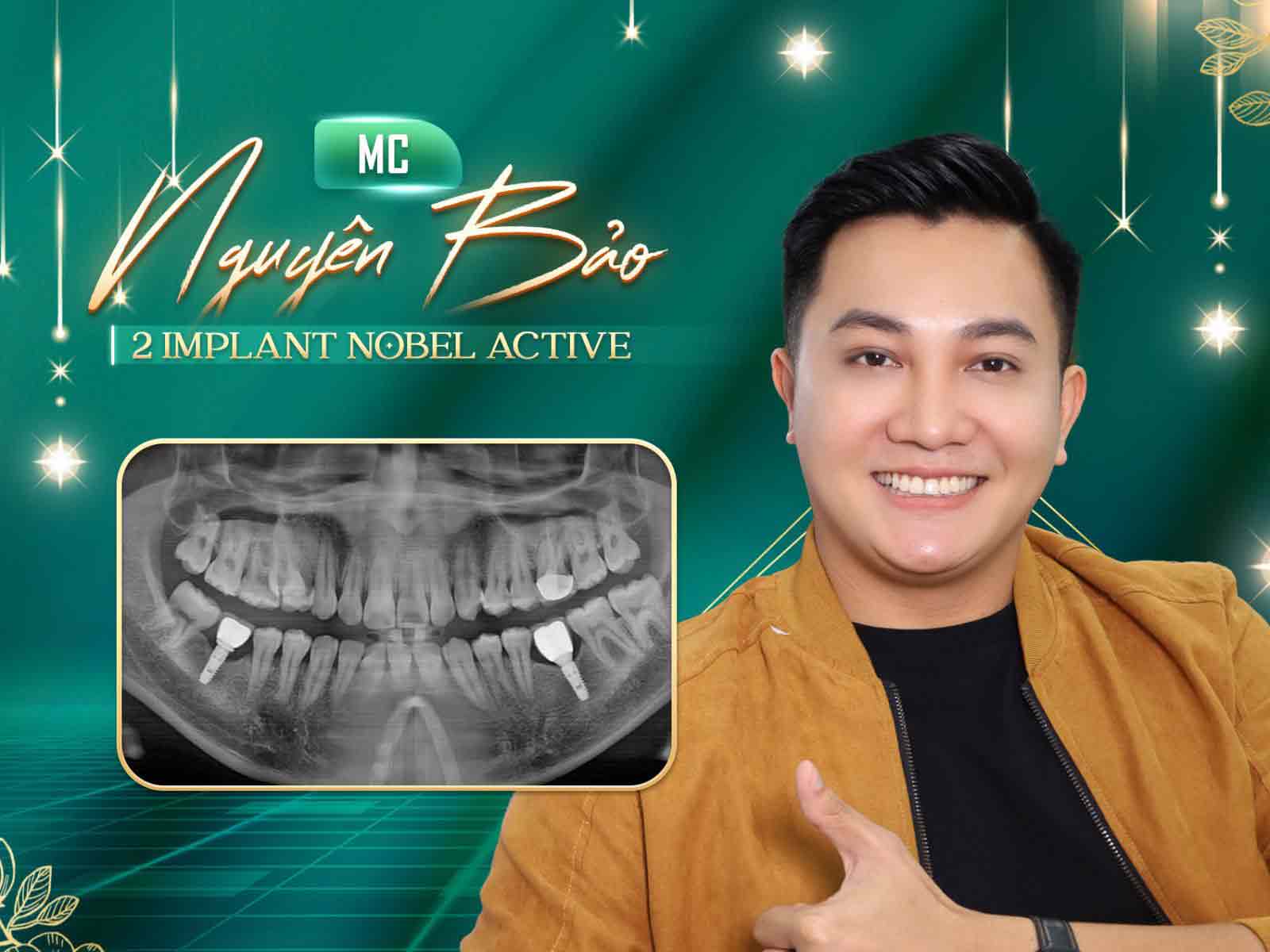 mc nguyên bảo