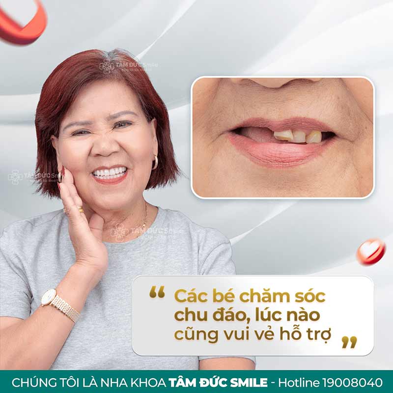 khách hàng làm răng tại nha khoa tâm đức smile