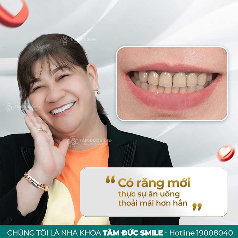 khách hàng làm răng tại nha khoa tâm đức smile