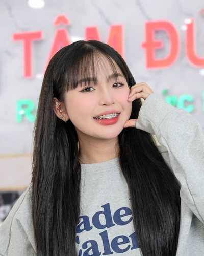 kh-nieng-rang-mac-cai